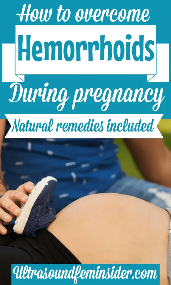 Hemorrhoids during pregnancy, how to prevent and treat ...