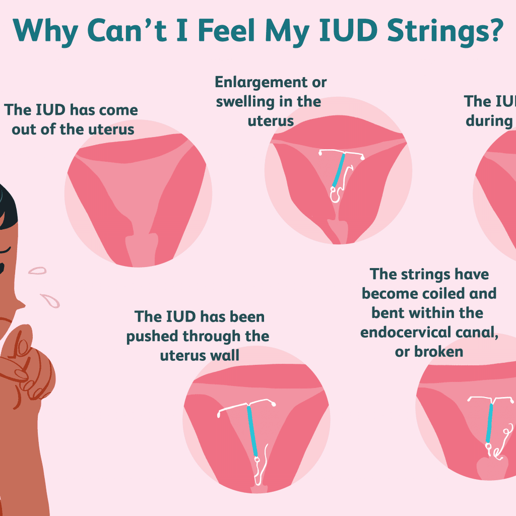 How Do I Know If I M Pregnant With Iud 5368